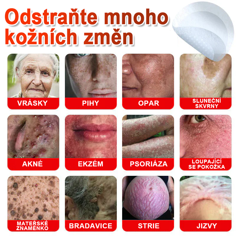 TLOPA® Mikrovpichová botanická náplast na odstranění kožních výrůstků 🇨🇿 Vyrobeno v Česká republika🎁