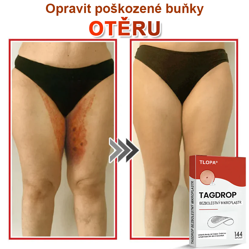 TLOPA® Mikrovpichová botanická náplast na odstranění kožních výrůstků 🇨🇿 Vyrobeno v Česká republika🎁