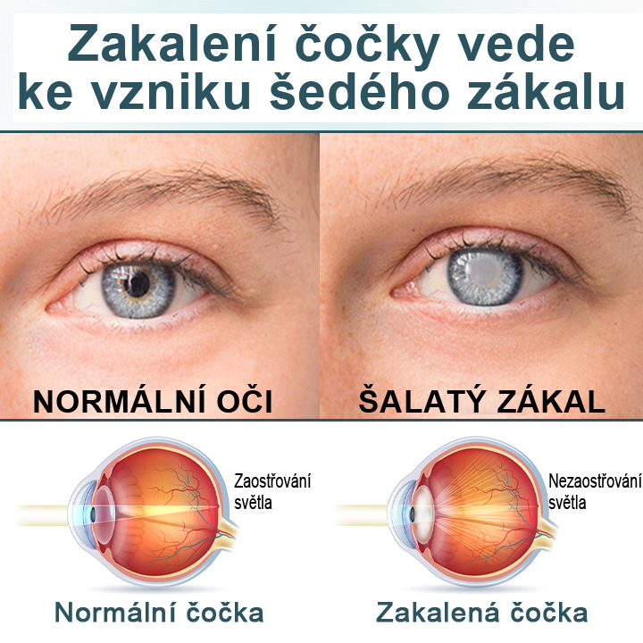 Oční kapky Timilk® optifusion nano sérum – nanotechnologie obnovuje jasný zrak, bez brýlí, bez chirurgického zákroku
