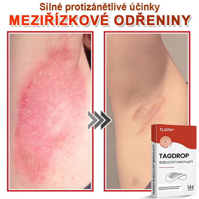 TLOPA® Mikrovpichová botanická náplast na odstranění kožních výrůstků 🇨🇿 Vyrobeno v Česká republika🎁
