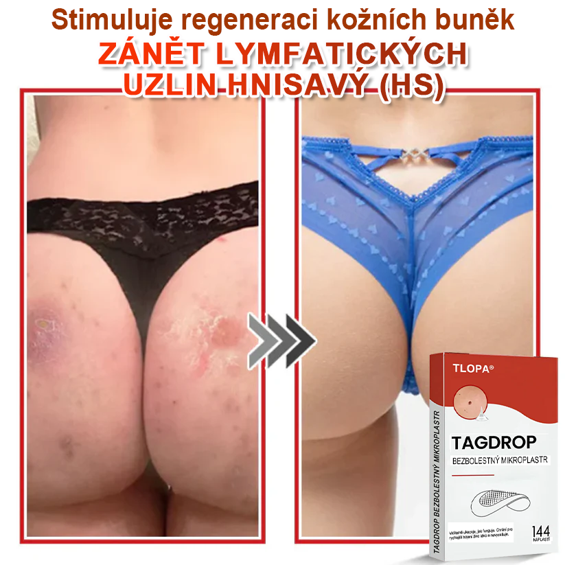 TLOPA® Mikrovpichová botanická náplast na odstranění kožních výrůstků 🇨🇿 Vyrobeno v Česká republika🎁