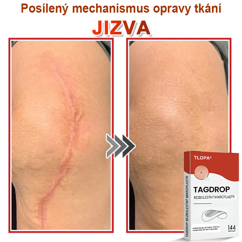 TLOPA® Mikrovpichová botanická náplast na odstranění kožních výrůstků 🇨🇿 Vyrobeno v Česká republika🎁