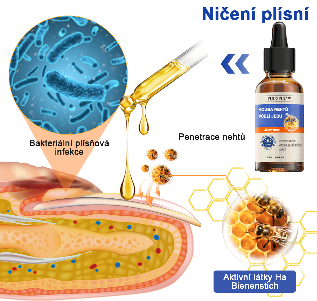 🐝🐝Furzero™ Včelí jed na plíseň nehtů: kompletní řešení plísně nehtů 🌟👣