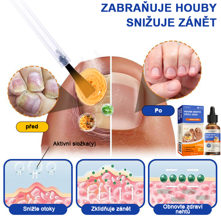 🐝🐝Furzero™ Včelí jed na plíseň nehtů: kompletní řešení plísně nehtů 🌟👣