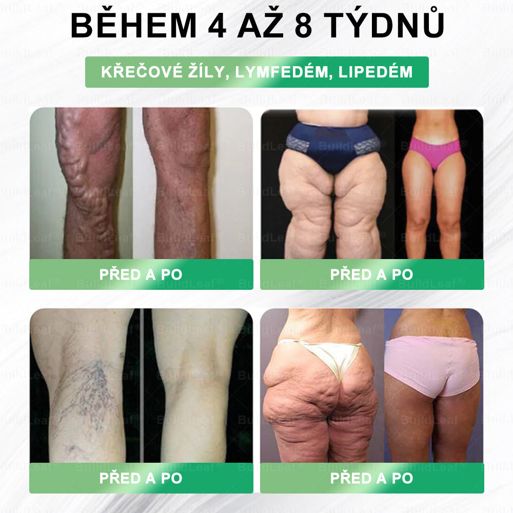 🏆Omezené zásoby! BuildLeaf®🎁Extra sleva 30 %! Obnovte své tělo a zdraví. Nenechte si to ujít.🎁🎁