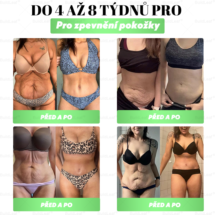 🏆Omezené zásoby! BuildLeaf®🎁Extra sleva 30 %! Obnovte své tělo a zdraví. Nenechte si to ujít.🎁🎁