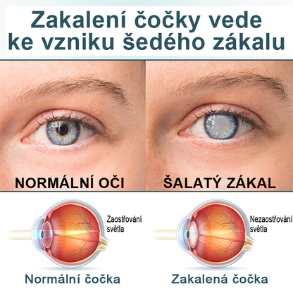 Oční kapky Timilk® optifusion nano sérum – nanotechnologie obnovuje jasný zrak, bez brýlí, bez chirurgického zákroku✅✅