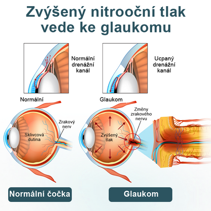 Oční kapky Timilk® optifusion nano sérum – nanotechnologie obnovuje jasný zrak, bez brýlí, bez chirurgického zákroku✅✅