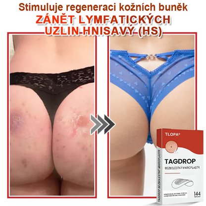 TLOPA® Mikrovpichová botanická náplast na odstranění kožních výrůstků 🇨🇿 Vyrobeno v Česká republika🎁
