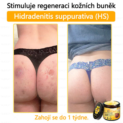 ✅VLSVLS™ Obnovující krém se včelím jedem🐝🐝🐝
