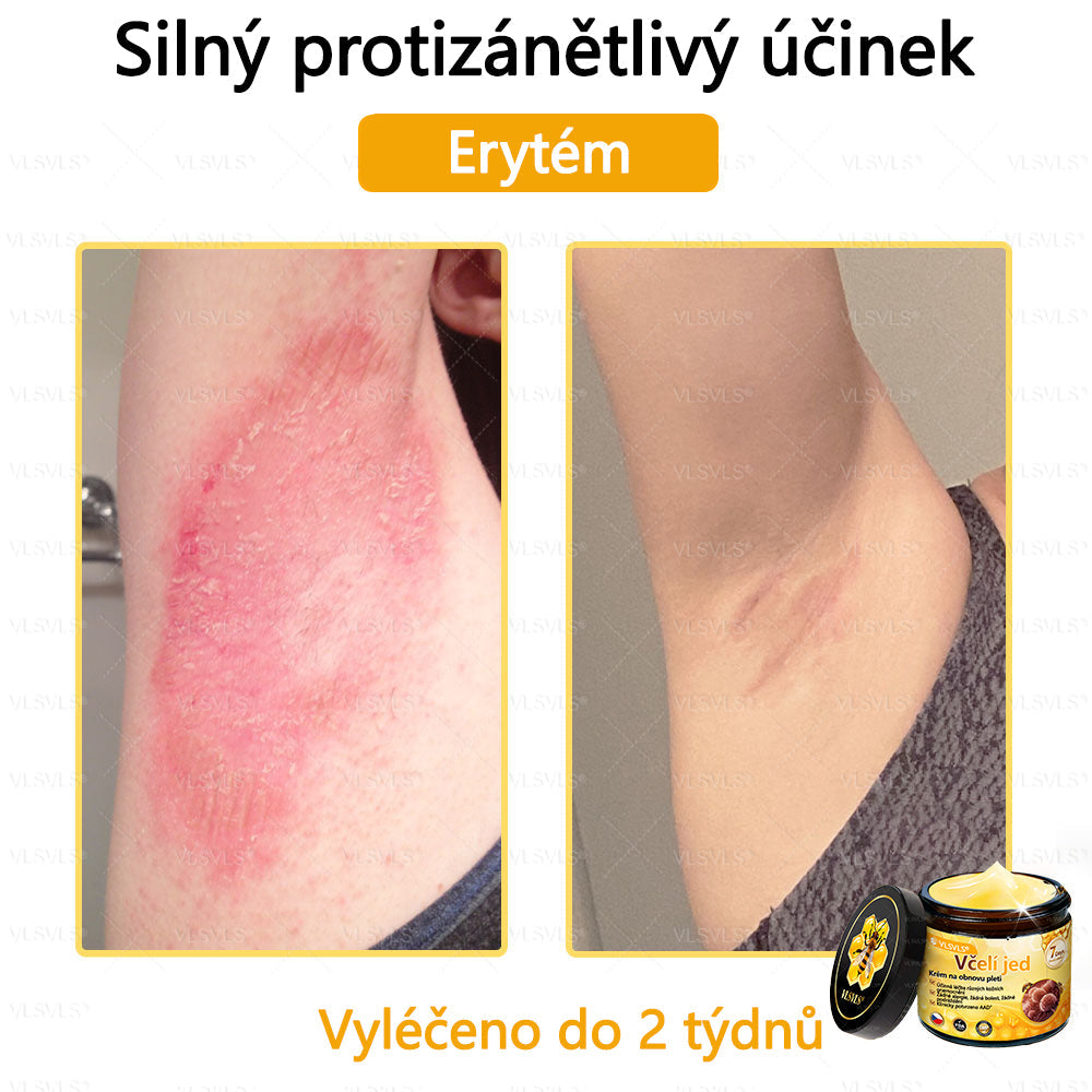 ✅VLSVLS™ Obnovující krém se včelím jedem🐝🐝🐝