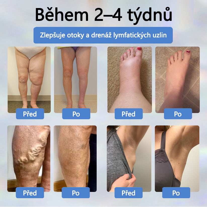 Cvreoz® Černý kmín Edema Detoxikační bylinný krém✨✨✨