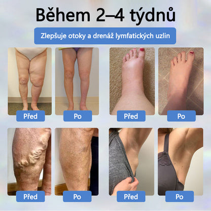 Cvreoz® Černý kmín Edema Detoxikační bylinný krém✨✨✨