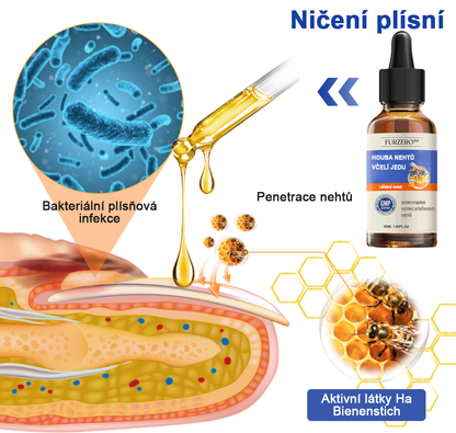 🐝🐝Furzero™ Včelí jed na plíseň nehtů: kompletní řešení plísně nehtů 🌟👣