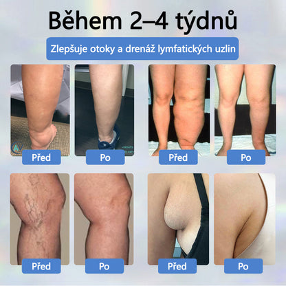 Cvreoz® Černý kmín Edema Detoxikační bylinný krém✨✨✨