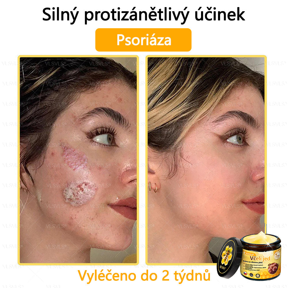 ✅VLSVLS™ Obnovující krém se včelím jedem🐝🐝🐝