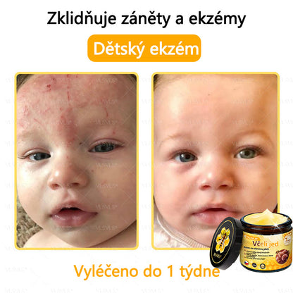 ✅VLSVLS™ Obnovující krém se včelím jedem🐝🐝🐝