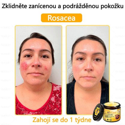 ✅VLSVLS™ Obnovující krém se včelím jedem🐝🐝🐝
