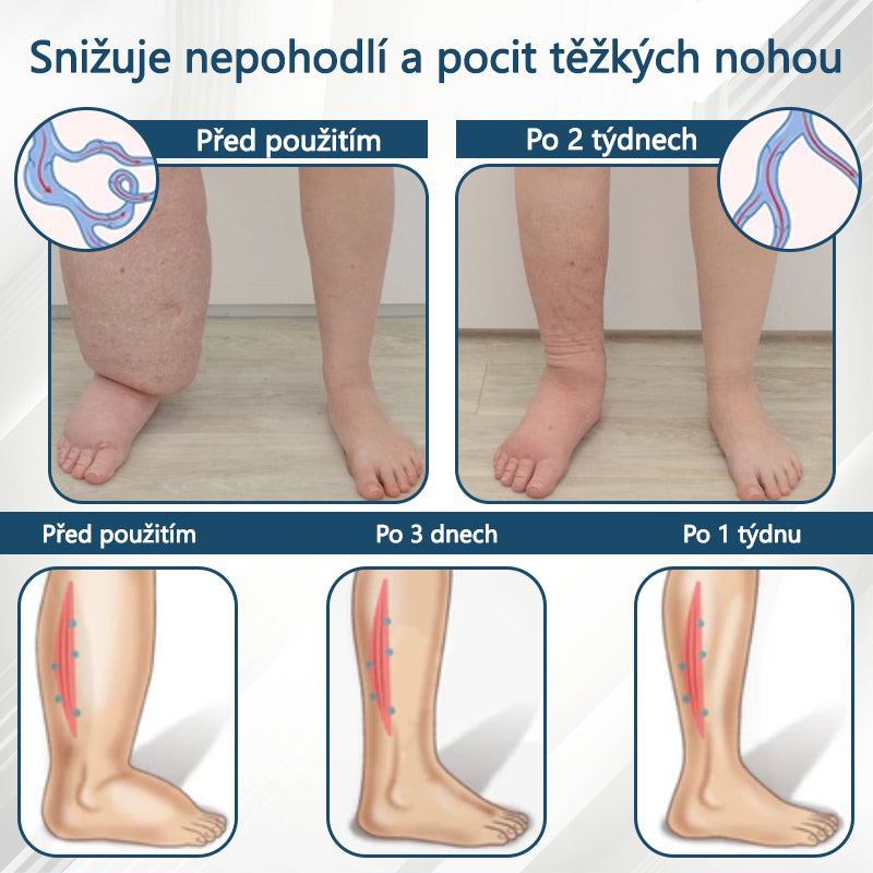 Cvreoz® Černý kmín Edema Detoxikační bylinný krém✨✨✨