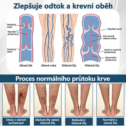 Cvreoz® Černý kmín Edema Detoxikační bylinný krém✨✨✨