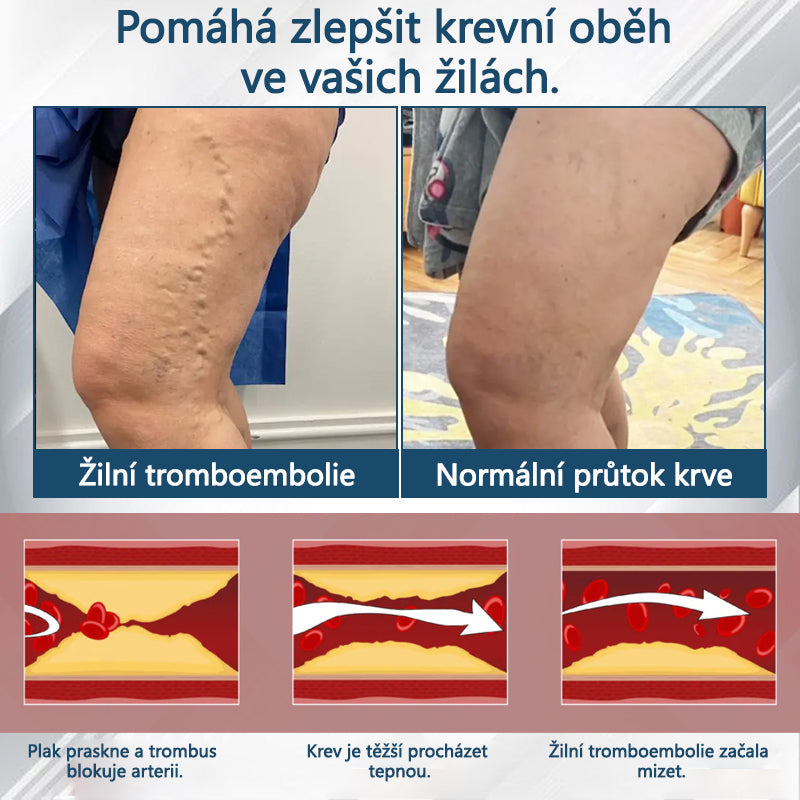 Cvreoz® Černý kmín Edema Detoxikační bylinný krém✨✨✨