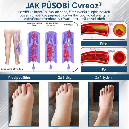 Cvreoz® Černý kmín Edema Detoxikační bylinný krém✨✨✨