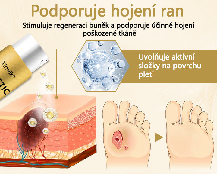 【Oficiální značkový obchod】Timilk® Sprej na hojení diabetické nohy - s obsahem včelího jedu🍃🍃
