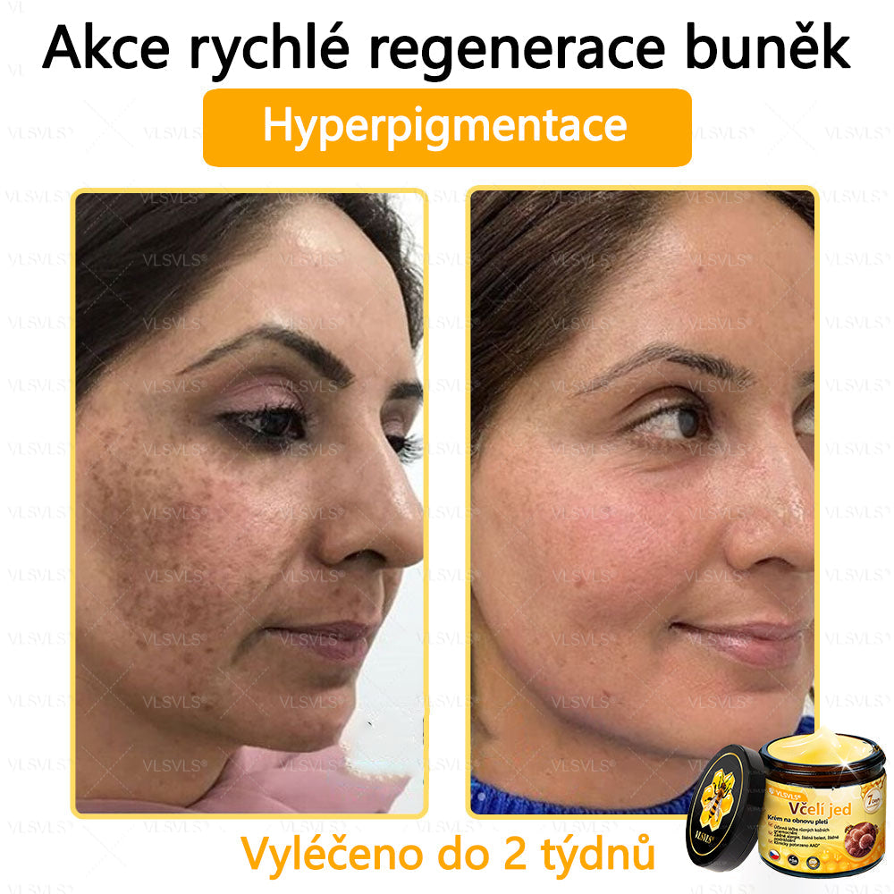 ✅VLSVLS™ Obnovující krém se včelím jedem🐝🐝🐝