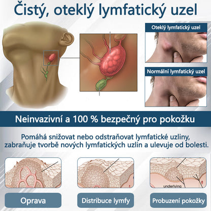 Cvreoz® Černý kmín Edema Detoxikační bylinný krém✨✨✨