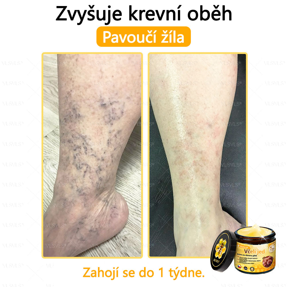 ✅VLSVLS™ Obnovující krém se včelím jedem🐝🐝🐝